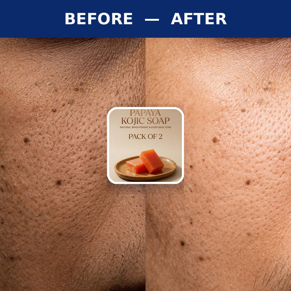 Papaya Kojic Soap for Skin Brightening Pack of 2