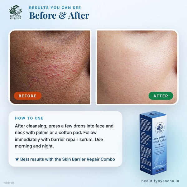 BARRIER REPAIR TONER