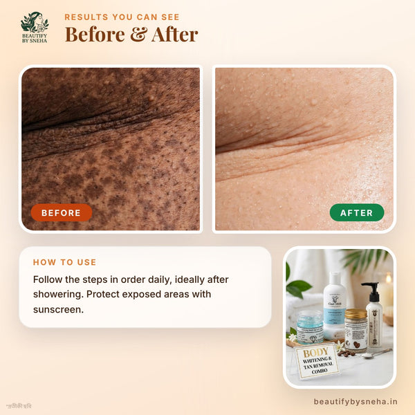 BODY WHITENING & TAN REMOVAL COMBO- ONLY FOR BODY