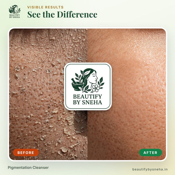 PIGMENTATION CLEANSER
