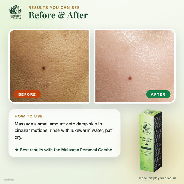 PIGMENTATION CLEANSER