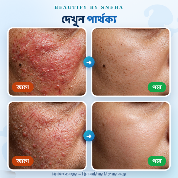 SKIN REPAIR COMBO - ALL SKIN TYPES