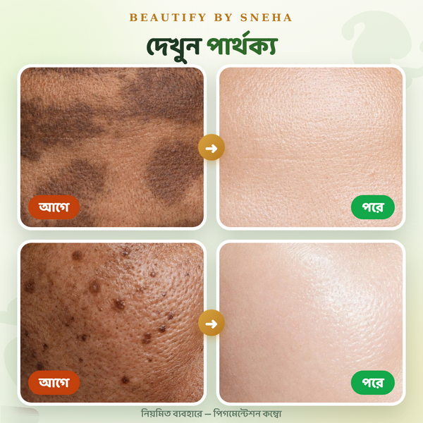 PIGMENTATION COMBO - THE ULTIMATE SOLUTION