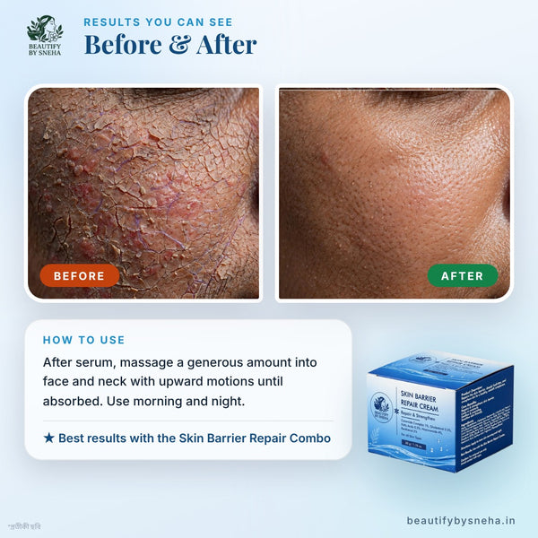 SKIN BARRIER REPAIR CREAM