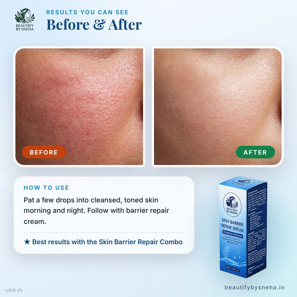 SKIN BARRIER REPAIR SERUM