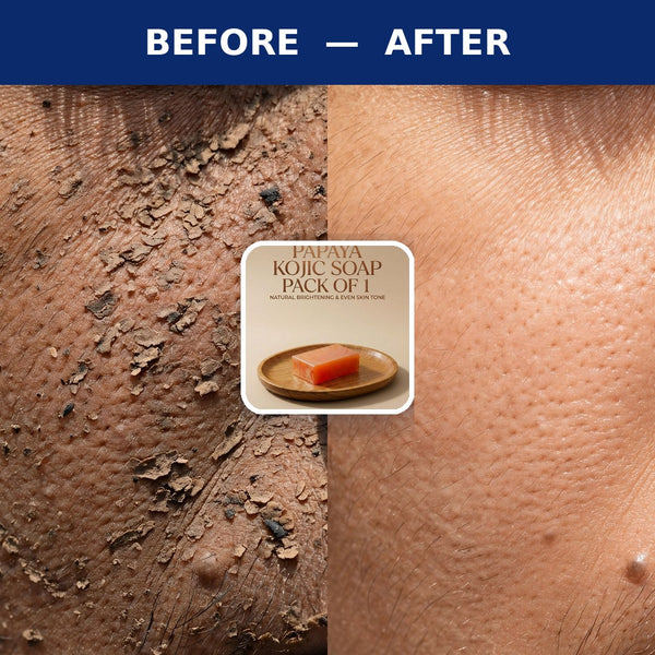 Papaya Kojic Soap for Skin Brightening Pack of 1