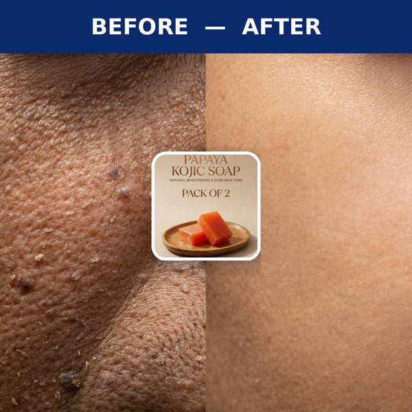 Papaya Kojic Soap for Skin Brightening Pack of 2