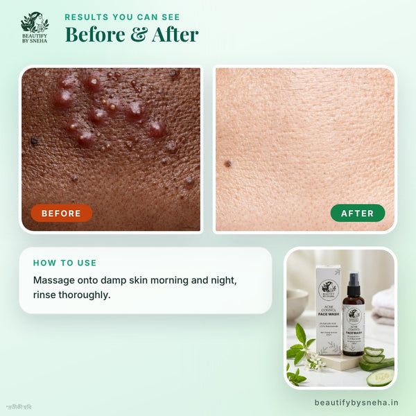 ACNE CONTROL FACEWASH