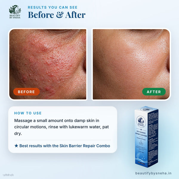 BARRIER REPAIR CLEANSER
