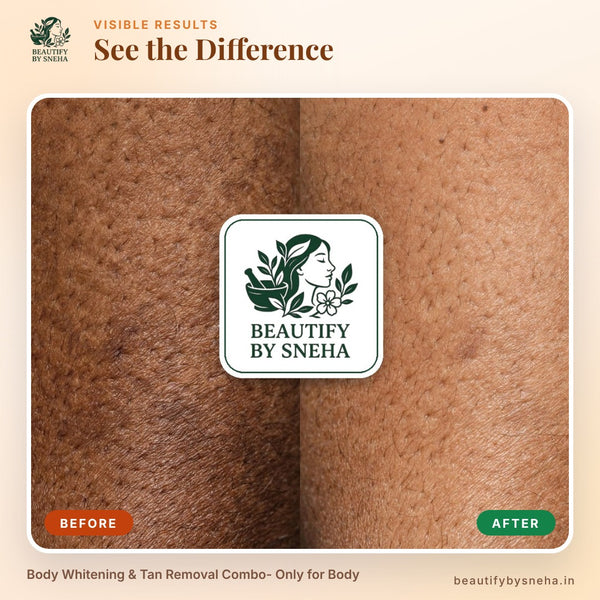 BODY WHITENING & TAN REMOVAL COMBO- ONLY FOR BODY