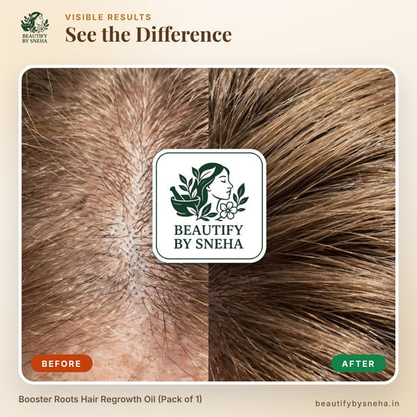 Booster Roots Hair Regrowth Oil (Pack of 1)
