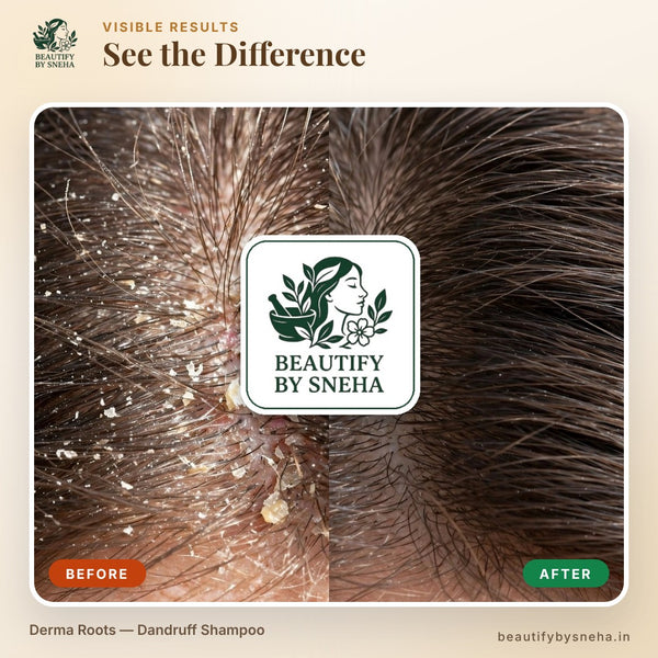 DERMA ROOTS - DANDRUFF SHAMPOO