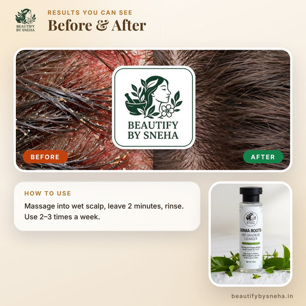 DERMA ROOTS - DANDRUFF SHAMPOO