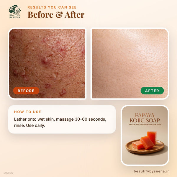 Papaya Kojic Soap for Skin Brightening Pack of 3