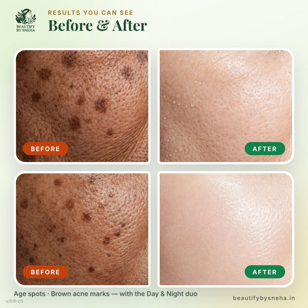 PIGMENTATION DAY & NIGHT CREAM COMBO