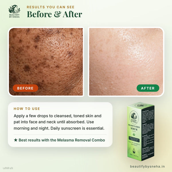 PIGMENTATION SERUM