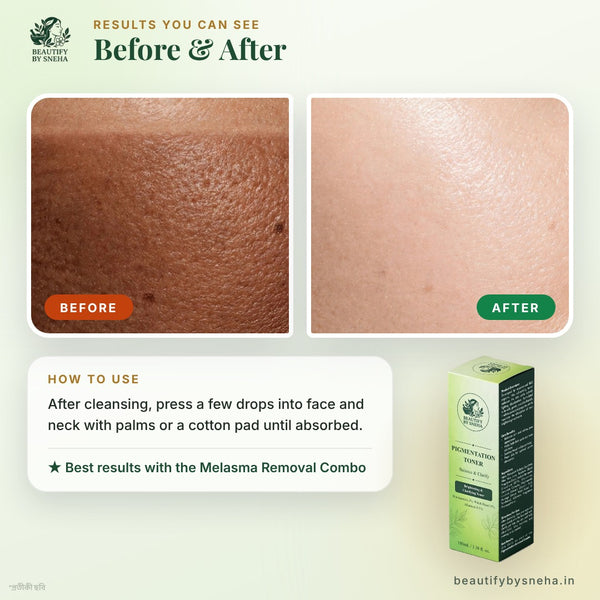 PIGMENTATION TONER