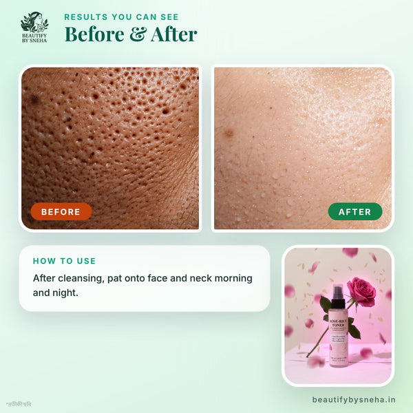 Pore Minimising Rose-Rice Toner with added Ceramides