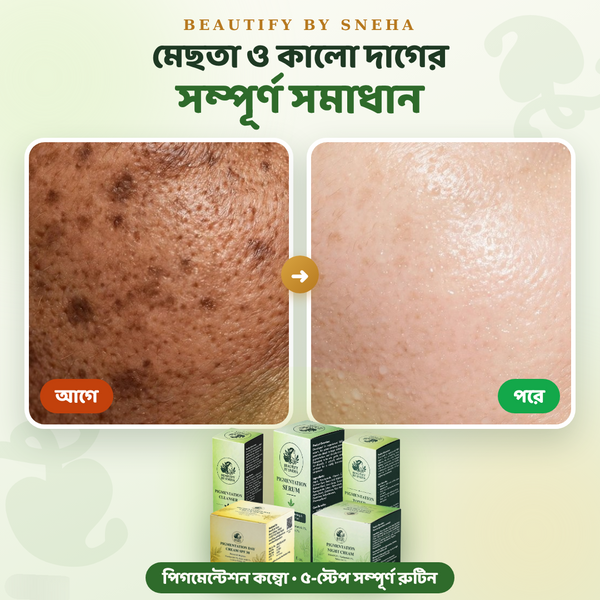 PIGMENTATION COMBO - THE ULTIMATE SOLUTION