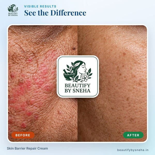 SKIN BARRIER REPAIR CREAM