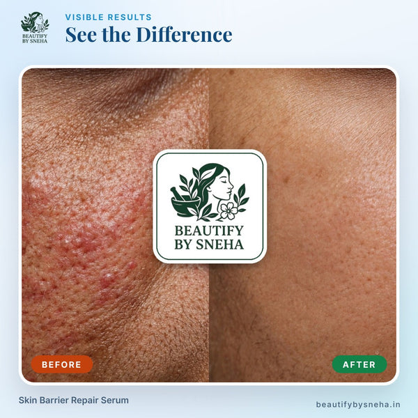 SKIN BARRIER REPAIR SERUM